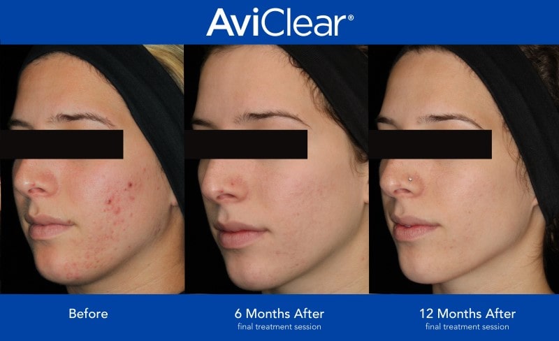 AviClear 6L-min