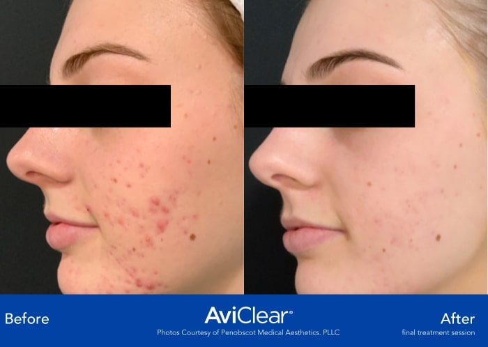 Penobscot Medical Aesthetics. PLLC (L)-min