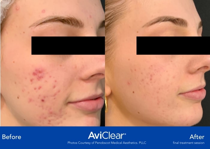 Penobscot Medical Aesthetics. PLLC (R)-min