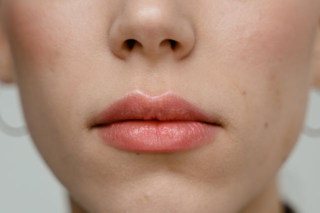 How to Correct a Weak Chin